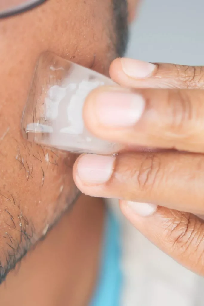 Apply Ice to Reduce Redness