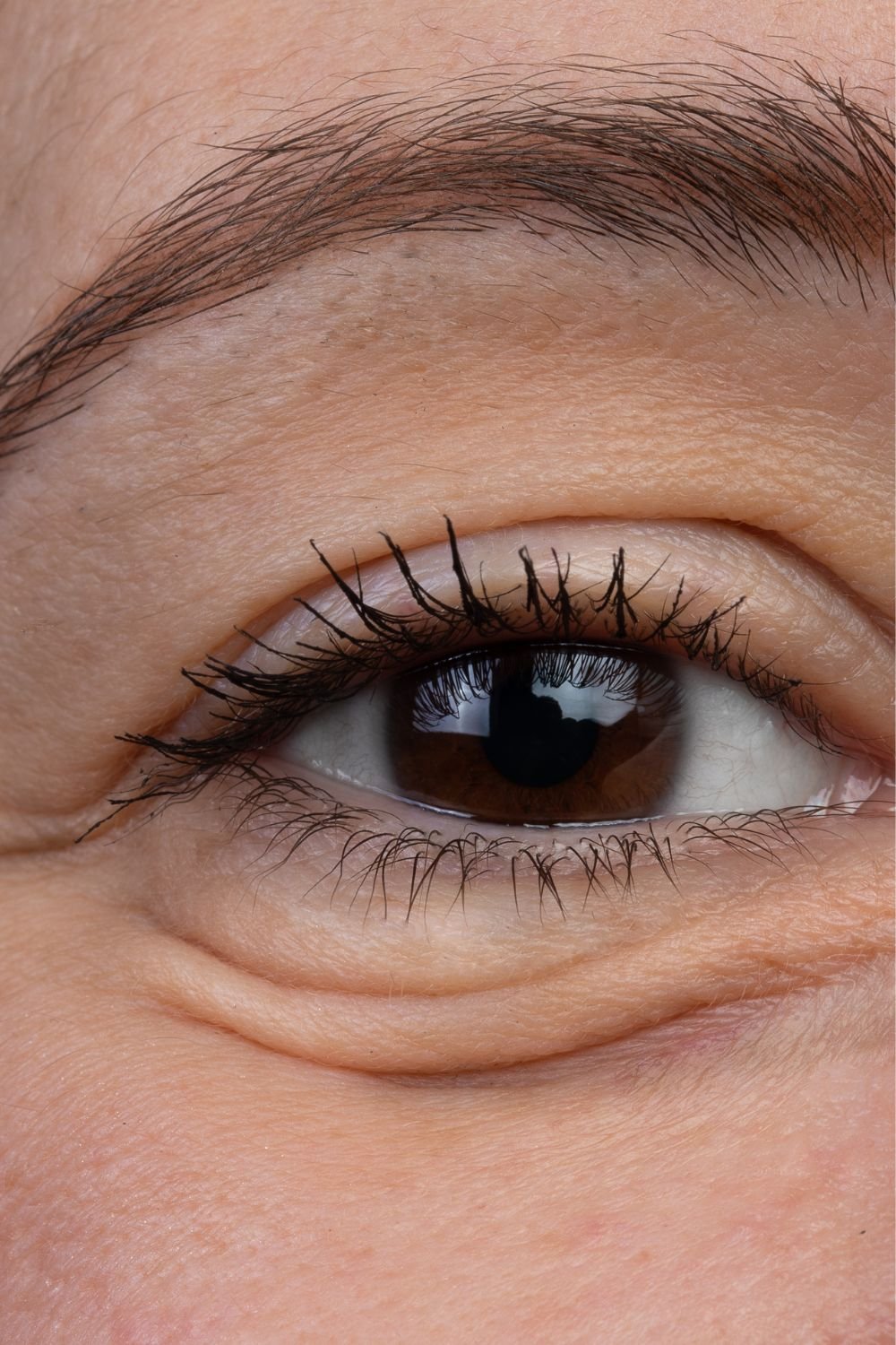 Cover Eye Bags With Makeup